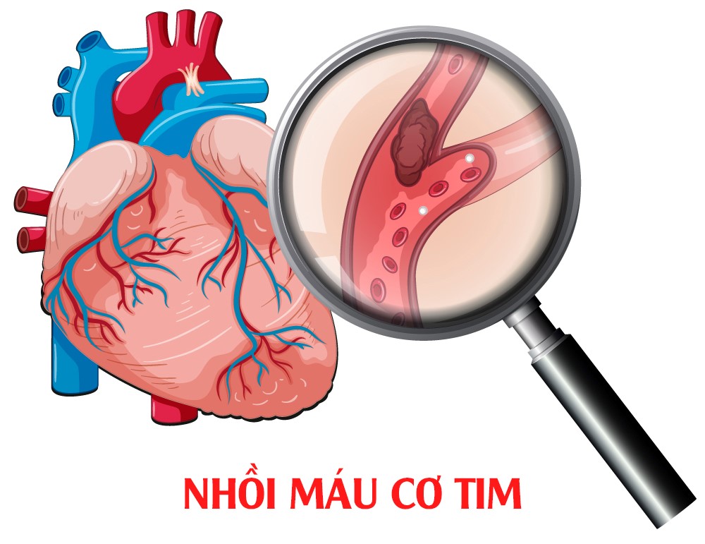Nhoi mau co tim